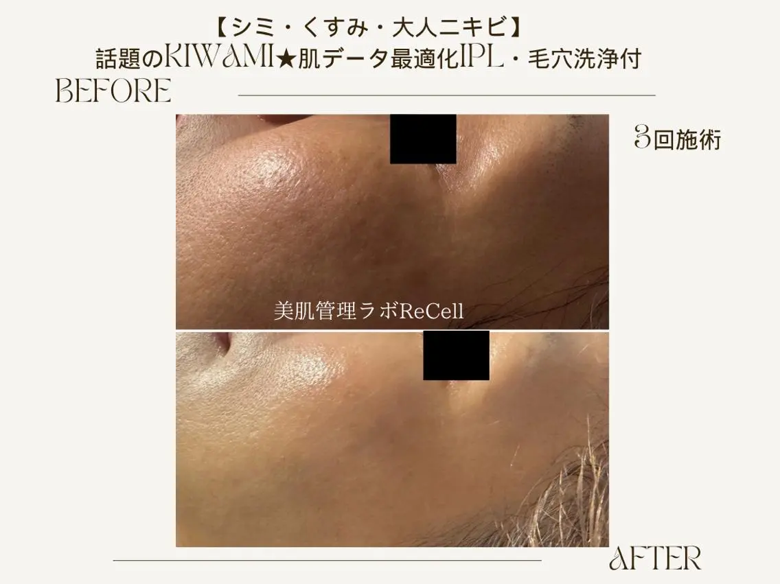 エステ ReCell 肌管理のエステ・リラクイメージ