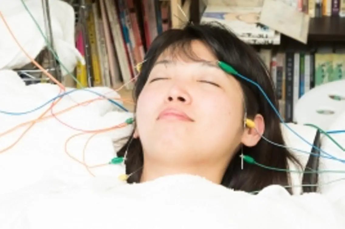 【プレミアム】biribiri美容鍼の写真