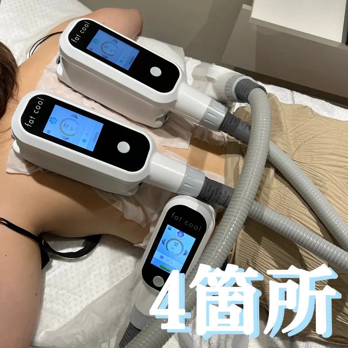 エステ 脂肪冷却痩身サロン SHIFT 東京のエステ・リラクイメージ