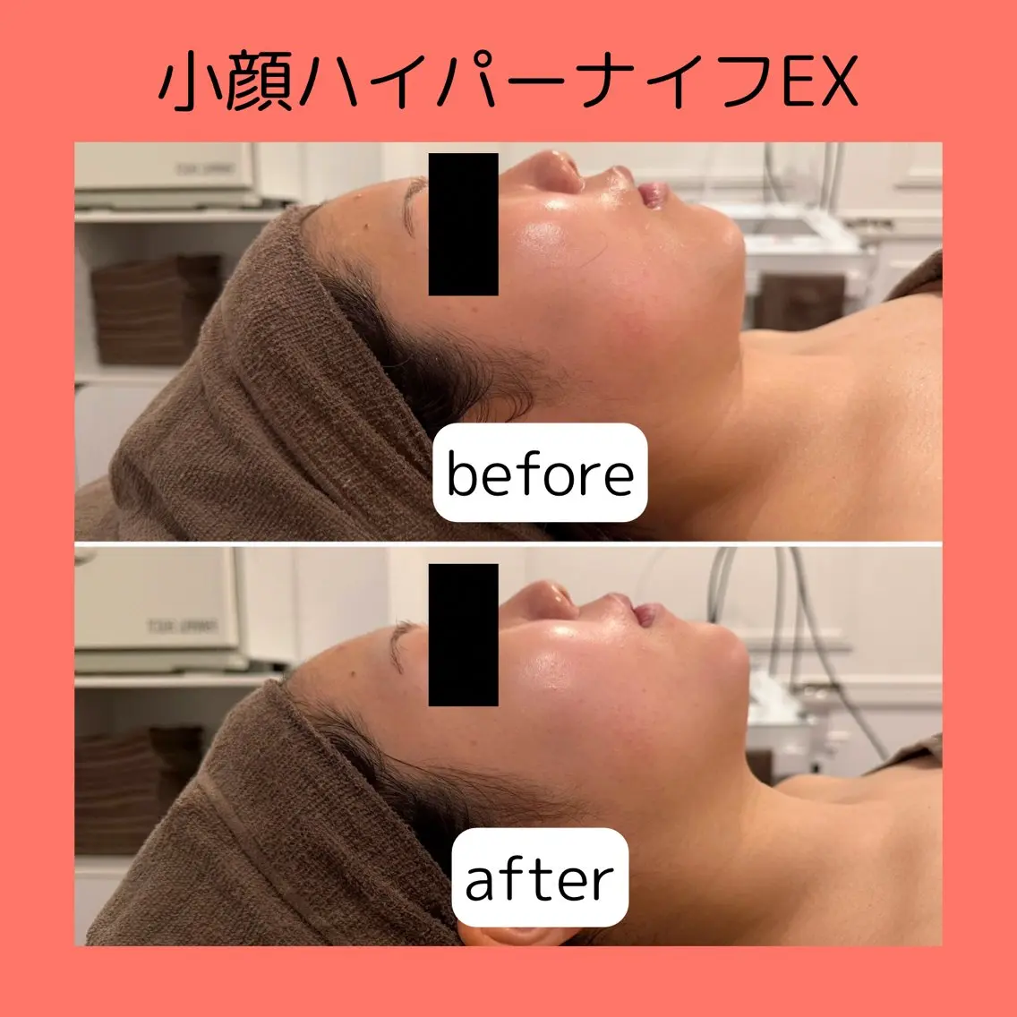 赤澤/本気痩せ・脱毛 ・ノーファンデ肌のエステ・リラクイメージ