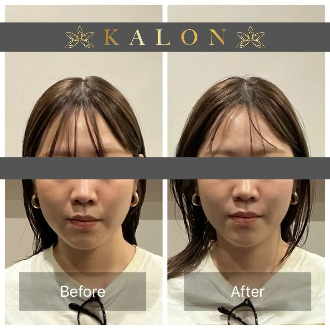 リラク 美容鍼×整体 KALONのその他イメージ