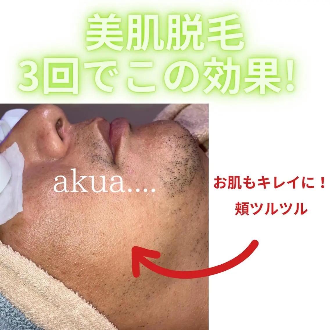 LUMINAルミナ 【肌管理サロン】のその他イメージ