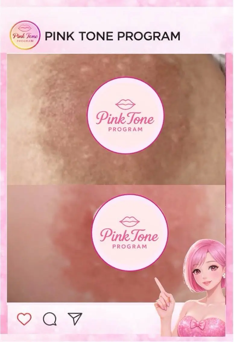 【バストトップのくすみケア】ピンクトーンバストケア初回の写真