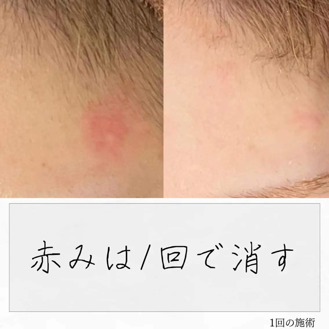 ニキビ経験者が施術 する専門サロン🌻のエステ・リラクイメージ