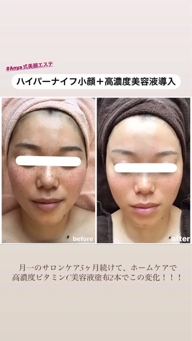 Anya Beautyのエステ・リラクイメージ