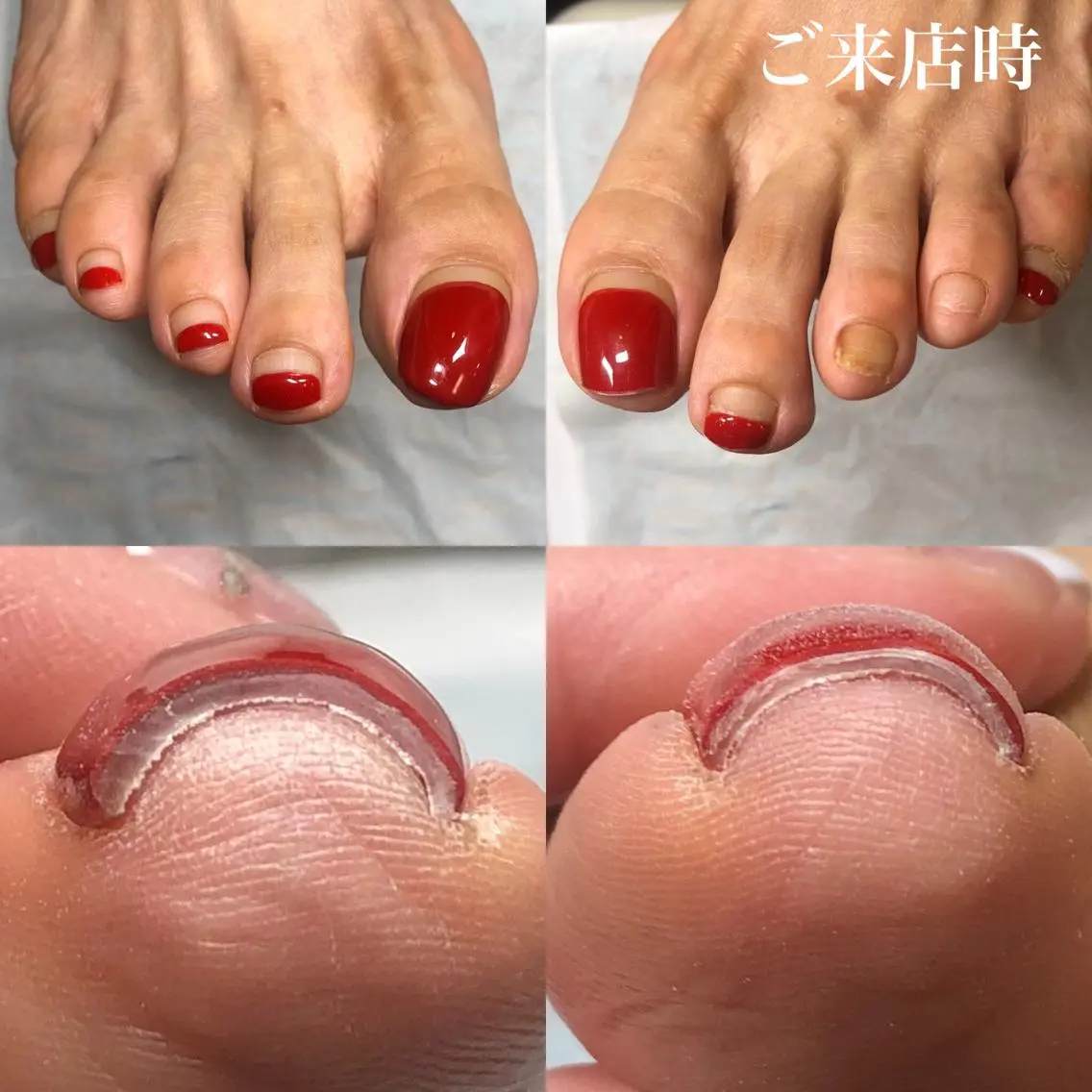 ネイル フットネイル .Nails Mio 赤羽西ネイルサロンのネイルデザイン