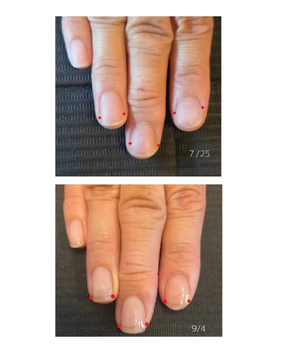 ネイル hana.nail 自爪育成サロンのネイルデザイン