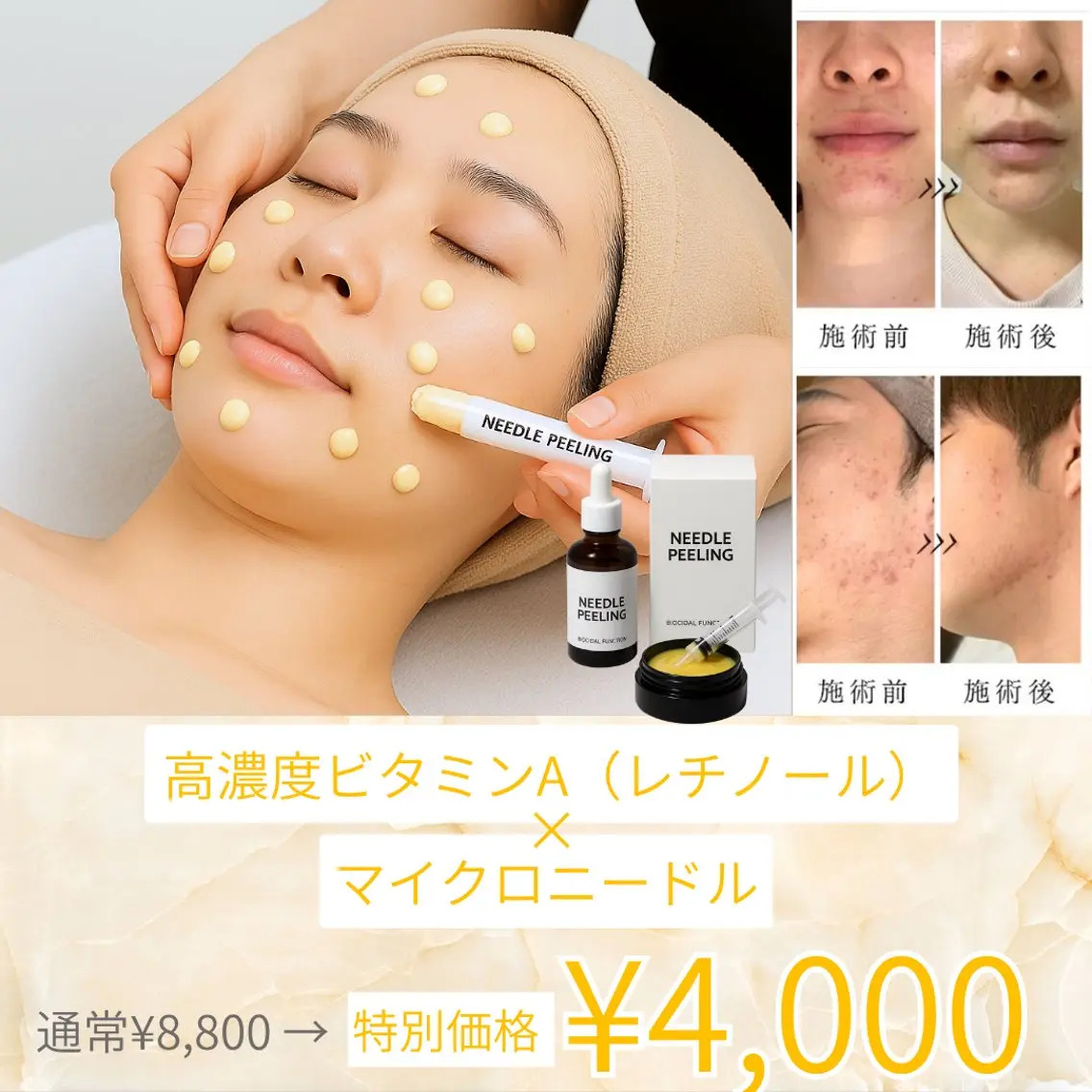 エステ BestBelleꕤ 大阪福島/肌質改善のエステ・リラクイメージ