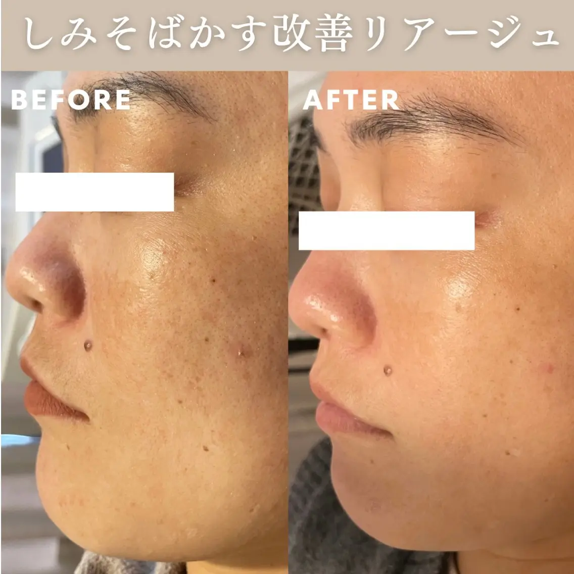 エステ Lassy Yuriの眉毛・アイブロウイメージ