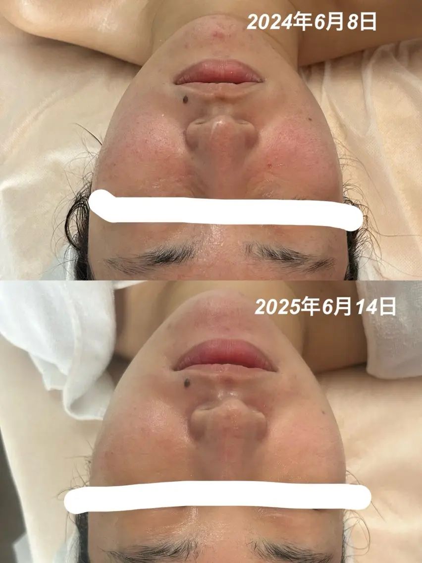 エステ 長谷川 望美のエステ・リラクイメージ