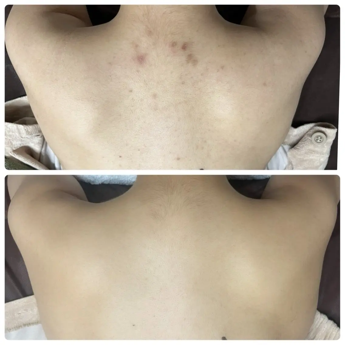 MI SUZUのエステ・リラクイメージ