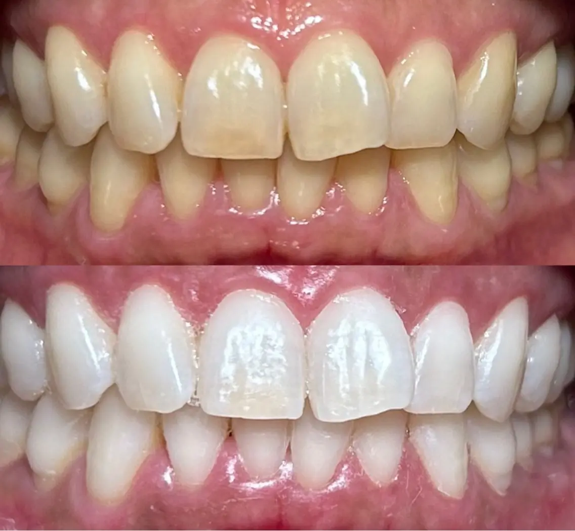 io teeth careのその他イメージ