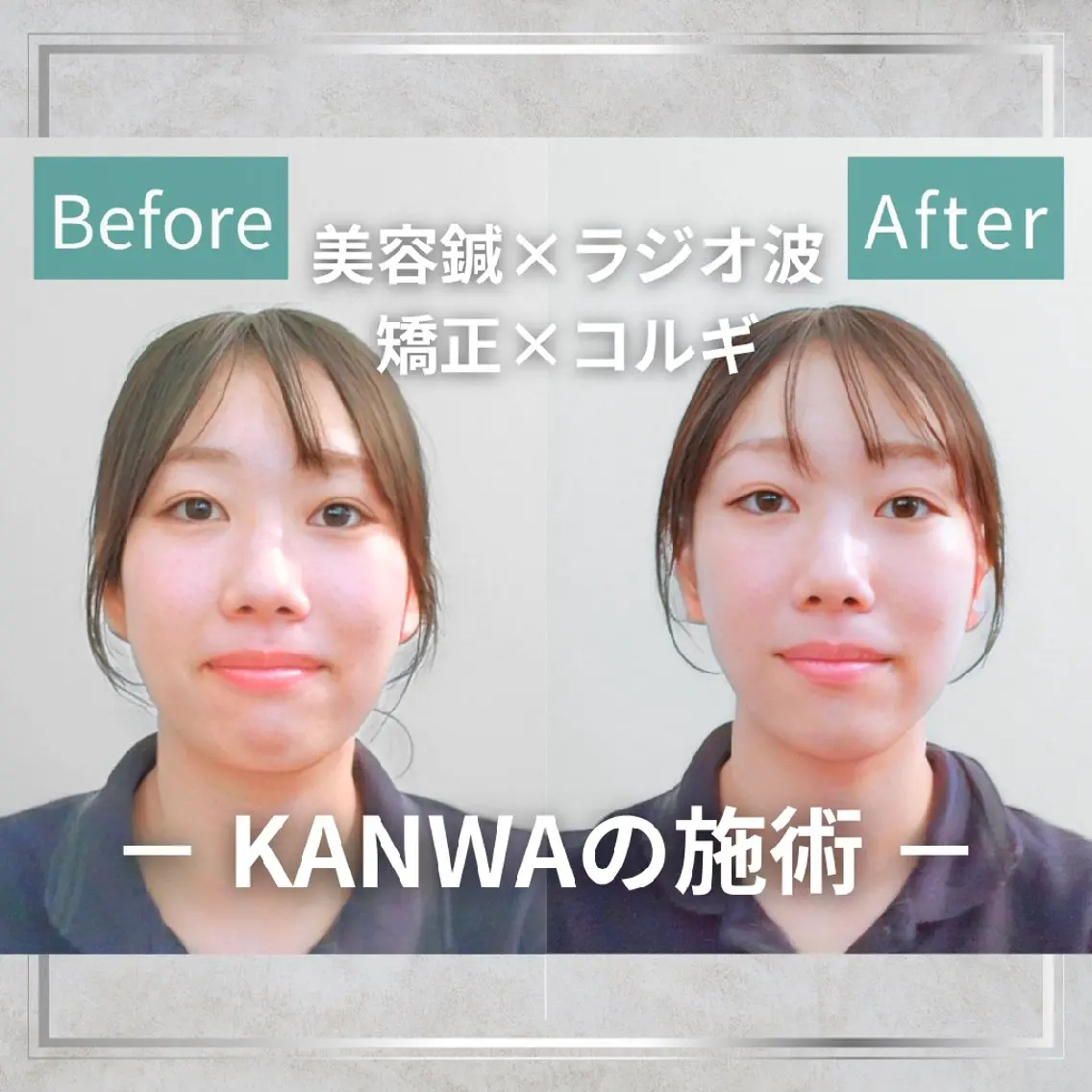 エステ リラク KANWA 鍼灸院のエステ・リラクイメージ