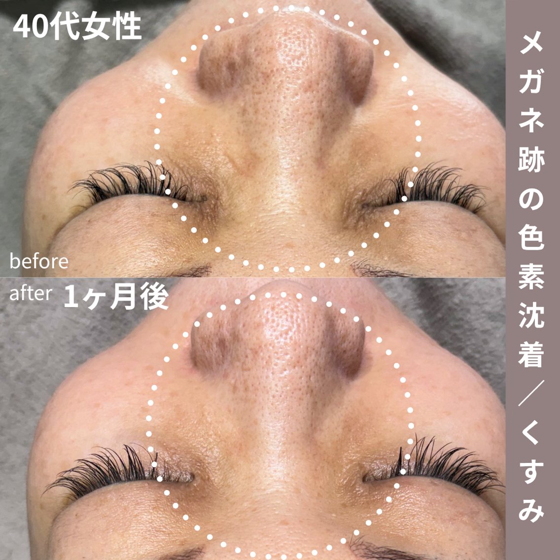 毛穴／肌管理サロン B SKINのエステ・リラクイメージ