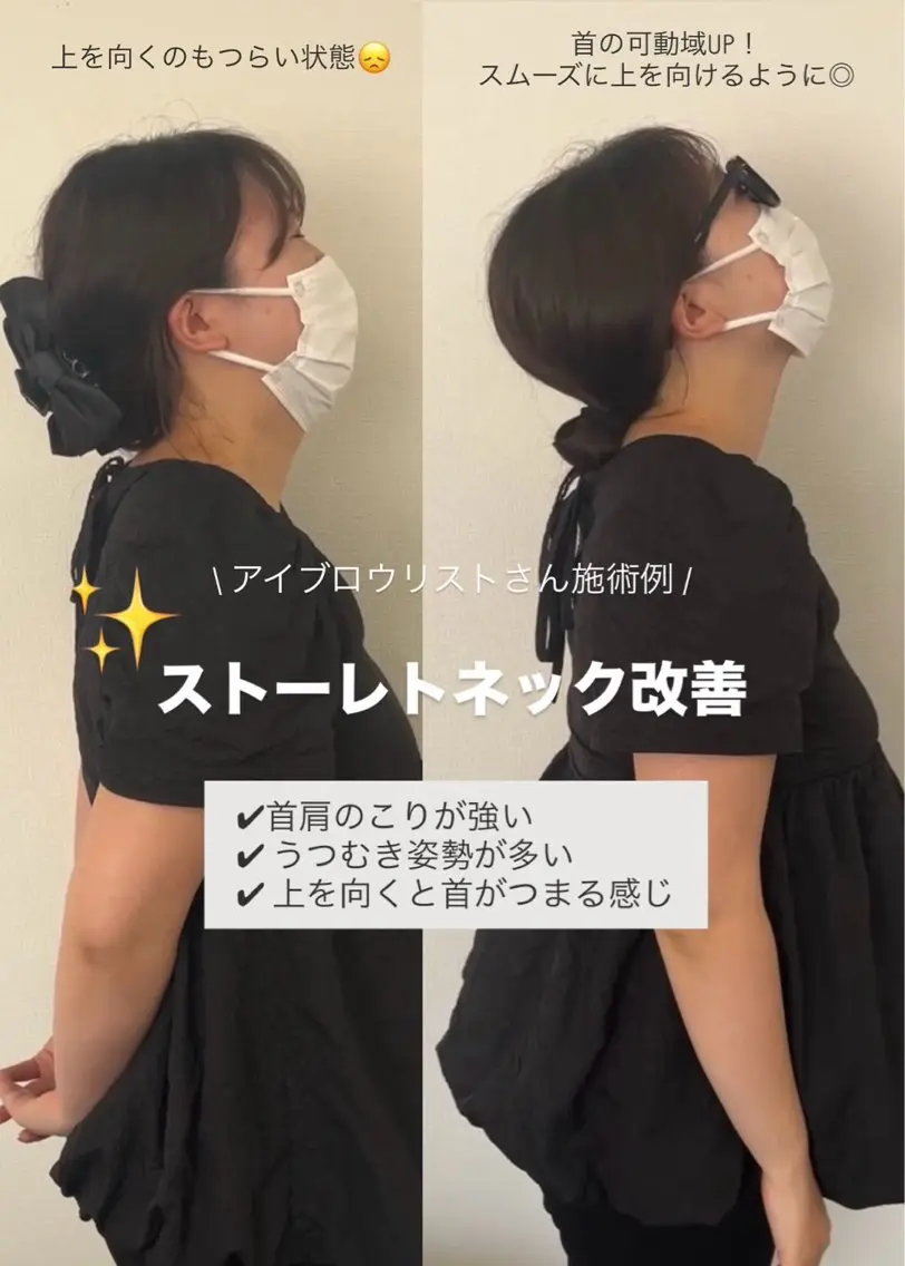 姿勢美人、首肩スッキリ猫背改善モニター限定10名様!!の写真