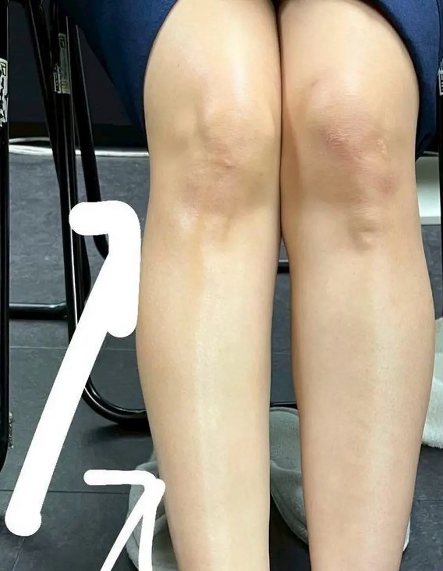 【◎膝下お気軽コース30分◎】両脚•膝下を最新美容機器を使い、ムクミを取り、 1回ですっきり軽い美脚へ！の写真