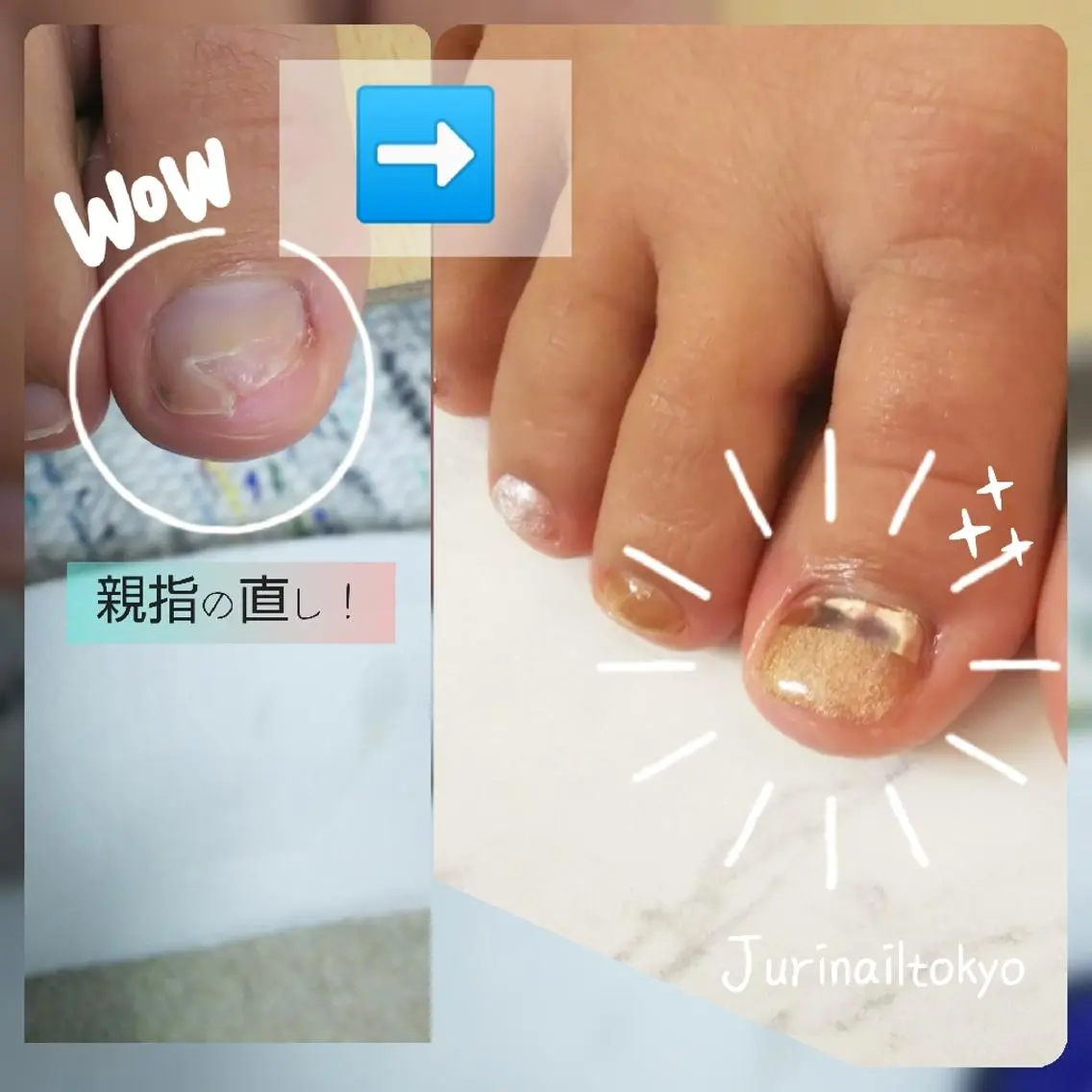 ネイル フットネイル jurinail tokyoのネイルデザイン