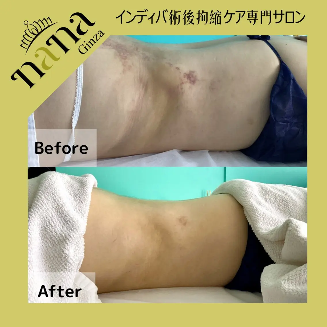 エステ Nana銀座Nina 高周波温熱専門サロンのエステ・リラクイメージ