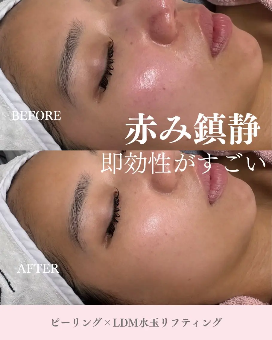 その他 THE PEACH スタッフのエステ・リラクイメージ