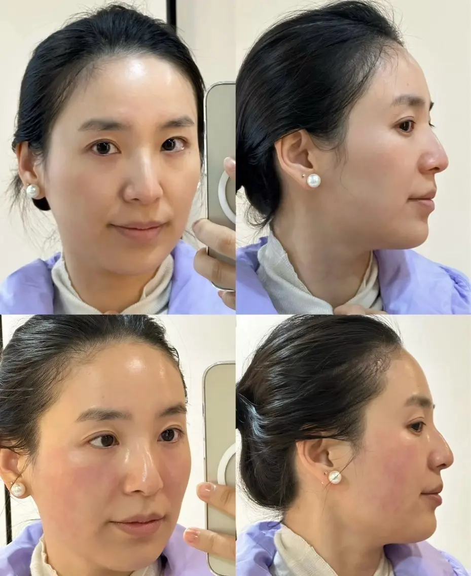 マツエク・マツパ エステ リラク 愛維美水光美肌専門店 メンズレディースokのエステ・リラクイメージ