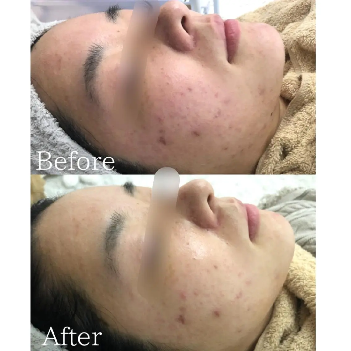 エステ 肌質改善サロン BestBelleのエステ・リラクイメージ
