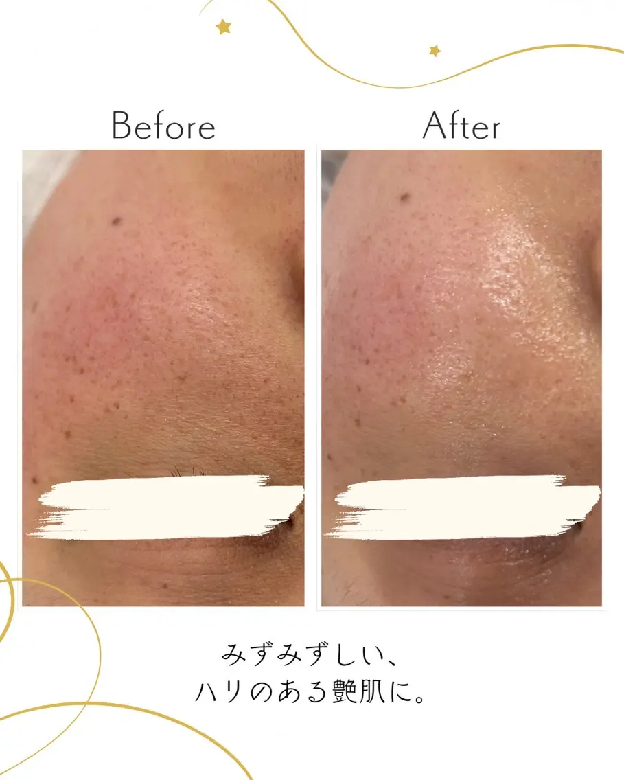 山下 泉のエステ・リラクイメージ