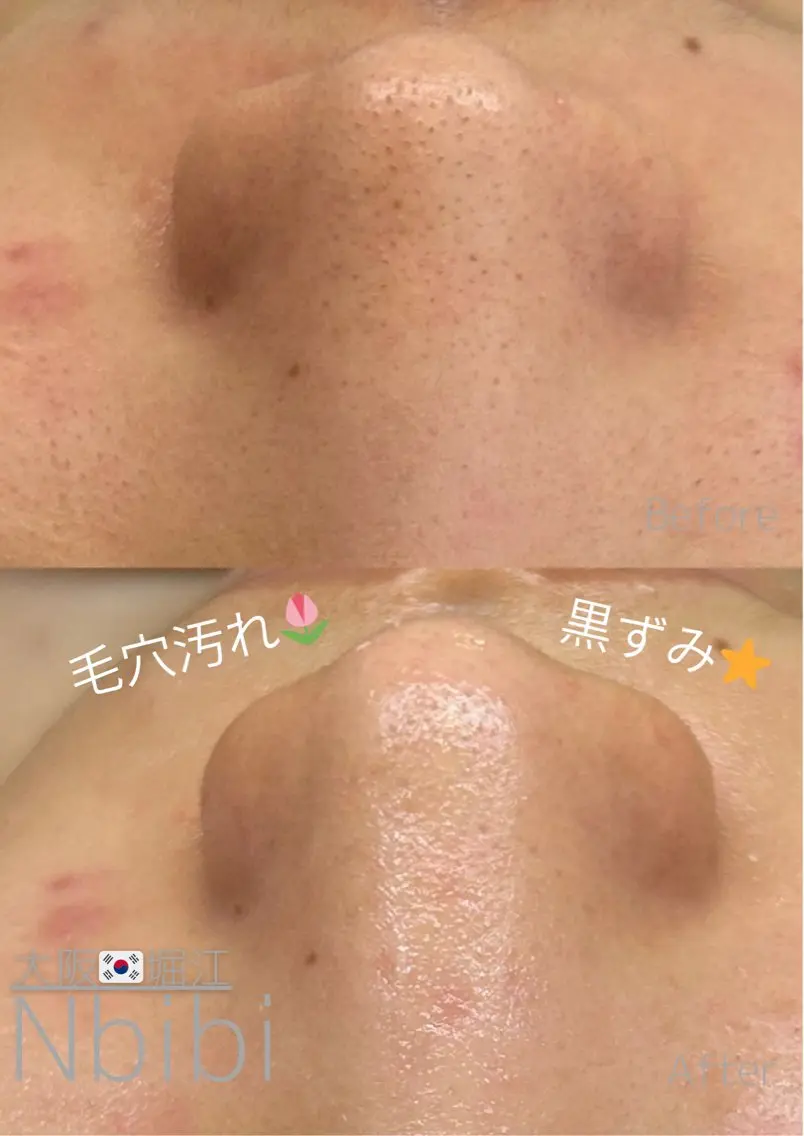 エステ 韓国🇰🇷価格 サロン_Nbibiの眉毛・アイブロウイメージ