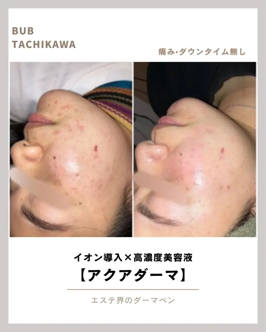 メンズ エステ 【BUB立川】 ゆかのエステ・リラクイメージ