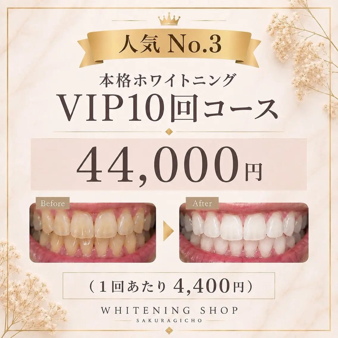 ホワイトニング ショップ桜木町店のエステ・リラクイメージ