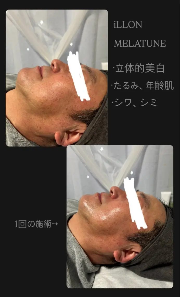 Myuraオーナー MIYUのエステ・リラクイメージ