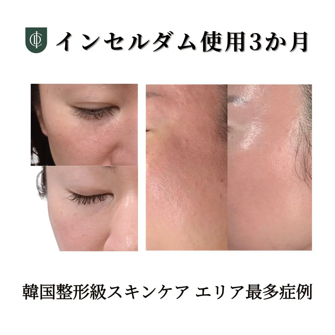 看護師 AYUIのエステ・リラクイメージ