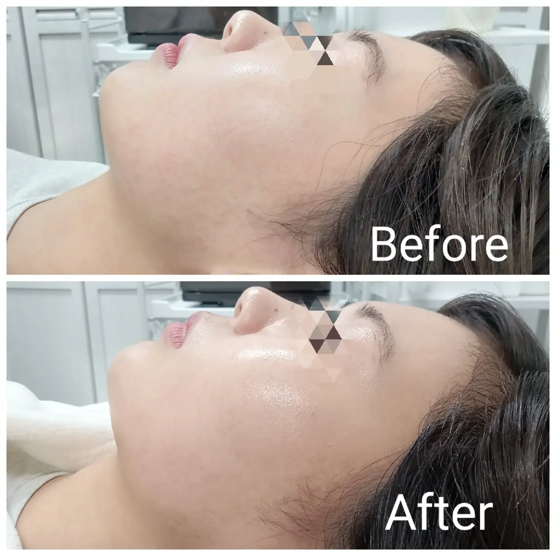 エステ リラク 肌質改善Beauty salon Renのエステ・リラクイメージ