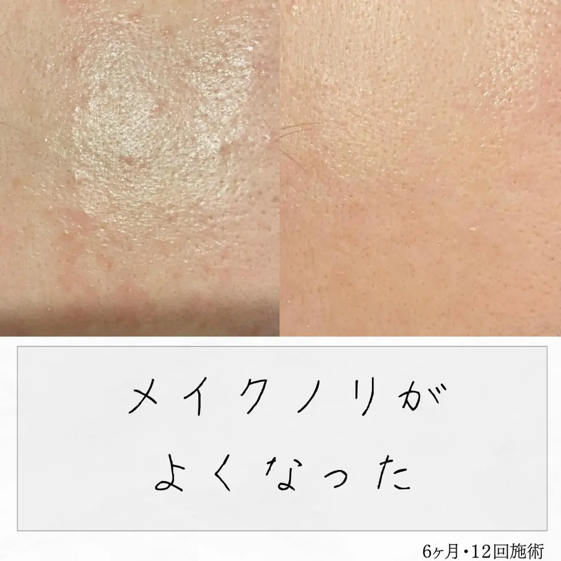ニキビ経験者が施術 する専門サロン🌻のエステ・リラクイメージ