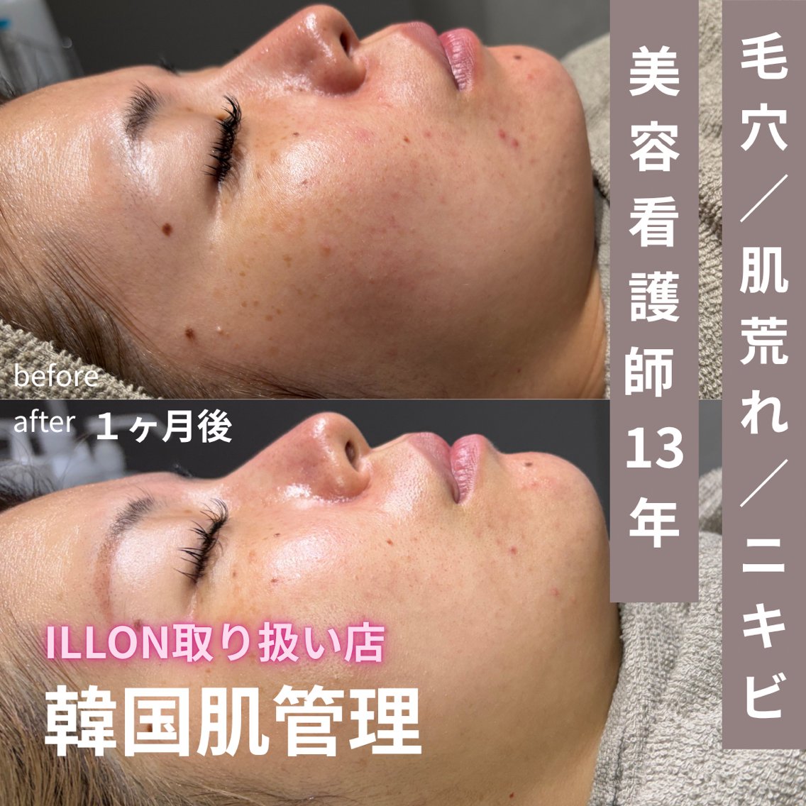 毛穴／肌管理サロン B SKINのエステ・リラクイメージ