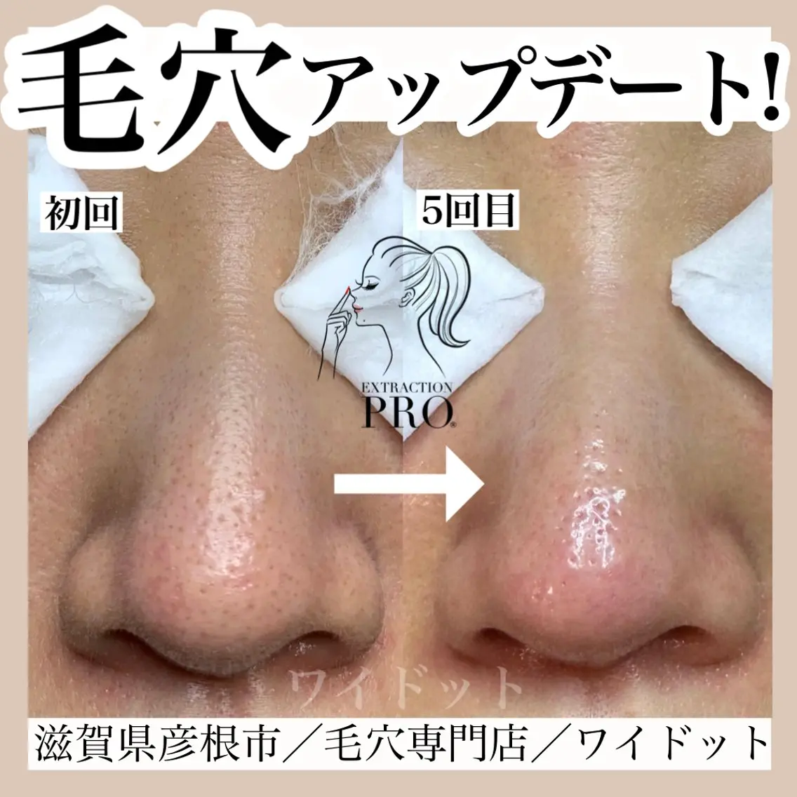 エステ Ydot. 池内 友架のエステ・リラクイメージ