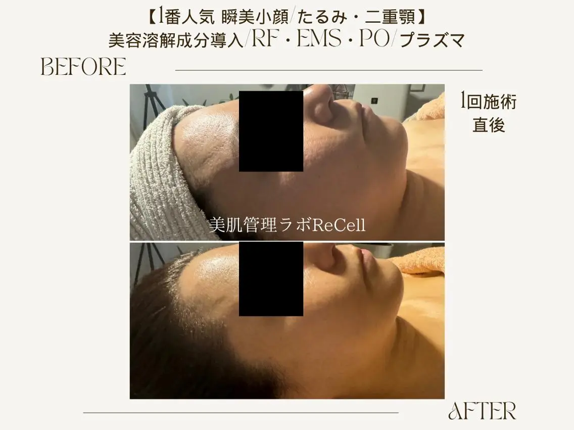 エステ ReCell 肌管理のエステ・リラクイメージ