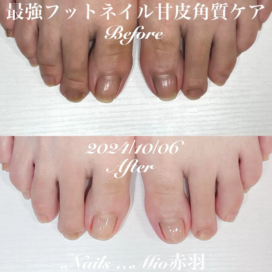 ネイル フットネイル フットネイル .Nails Mio 赤羽西ネイルサロンのネイルデザイン