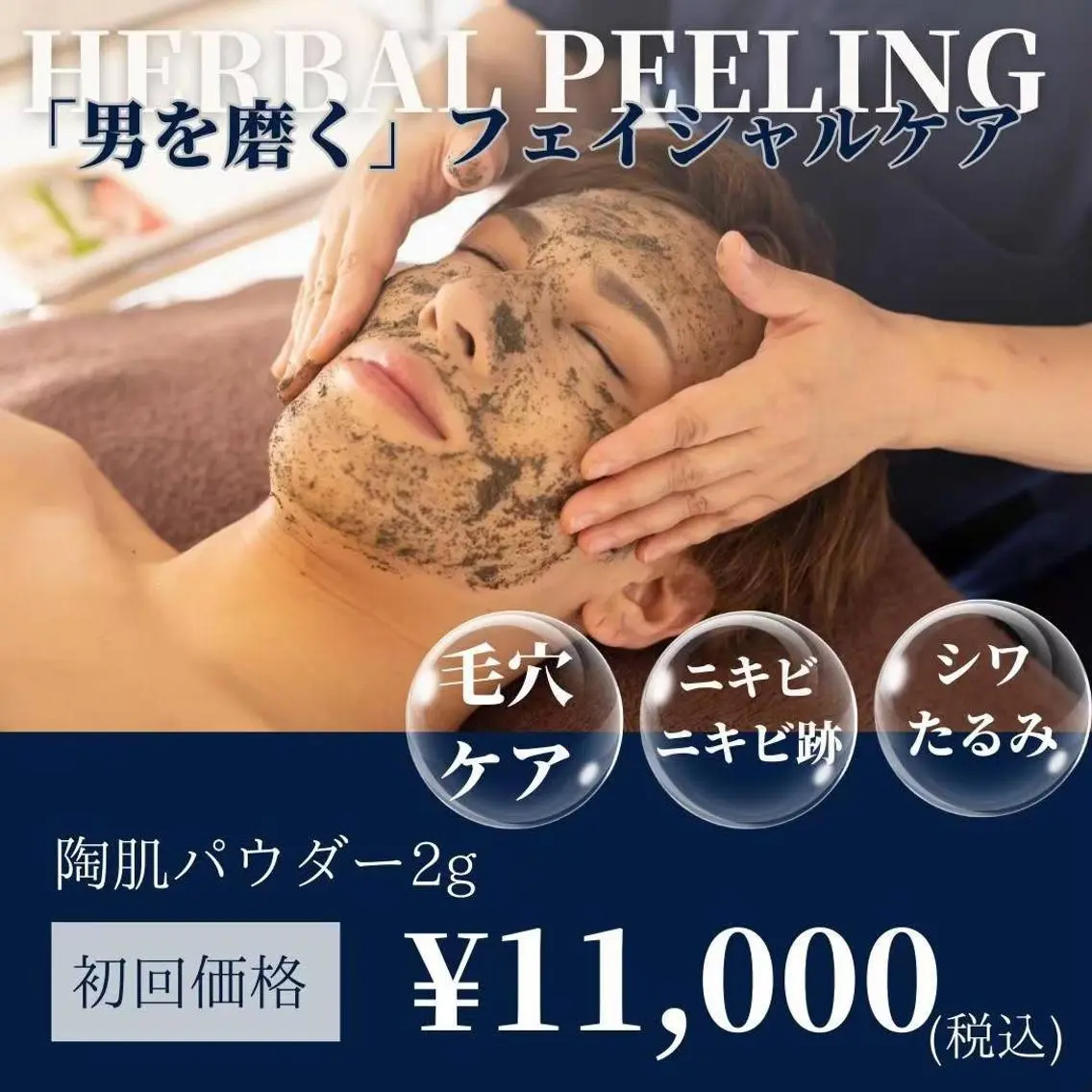 【メンズ専用】全顔REVIハーブピーリングの写真