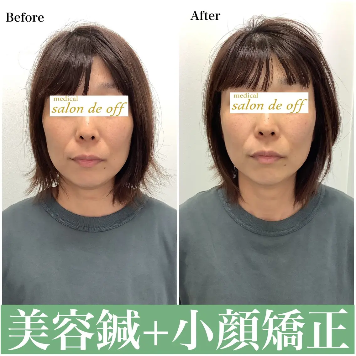 ハリサロンドオフ 美容鍼灸×小顔整体のエステ・リラクイメージ