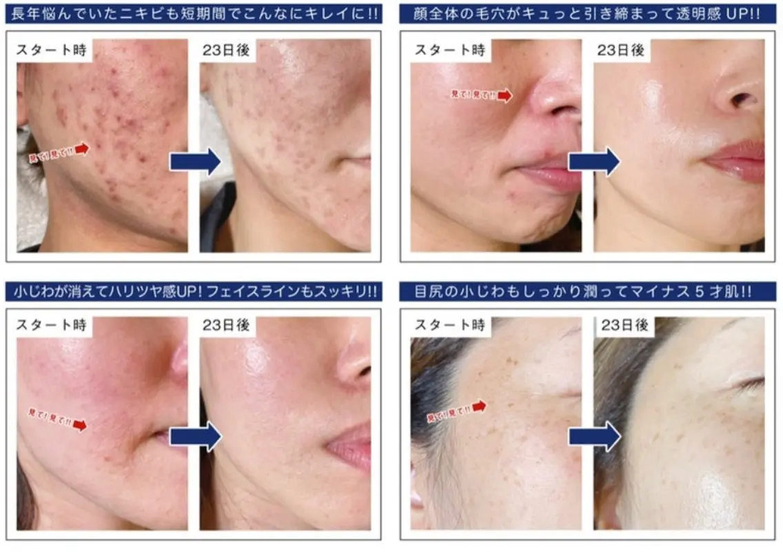 アンベリーノ Yuuriのエステ・リラクイメージ