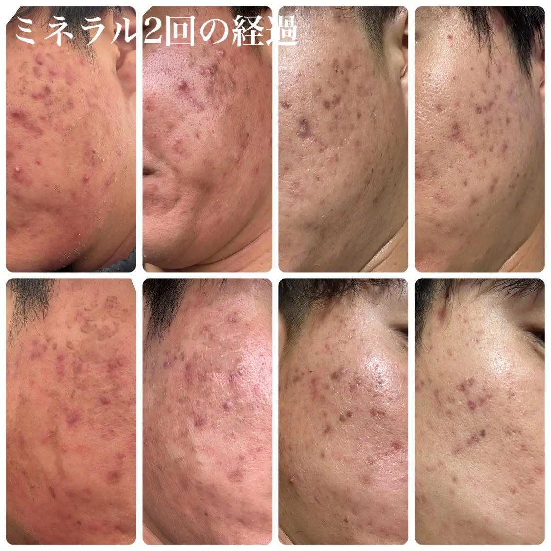 エステ 毛穴・肌質改善サロン ✨Tomaのエステ・リラクイメージ