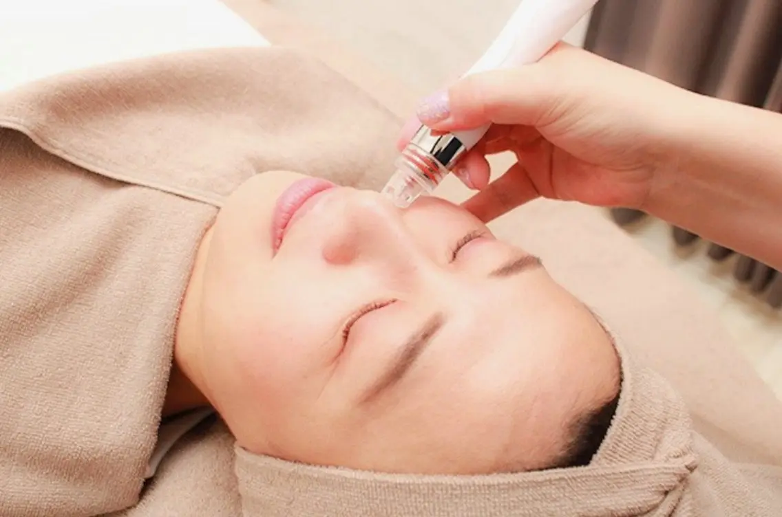 🩵ニキビ肌にお悩みの方専用️🩵【毛穴洗浄】×【水素ピーリング】＆幹細胞フェイシャルコースの写真