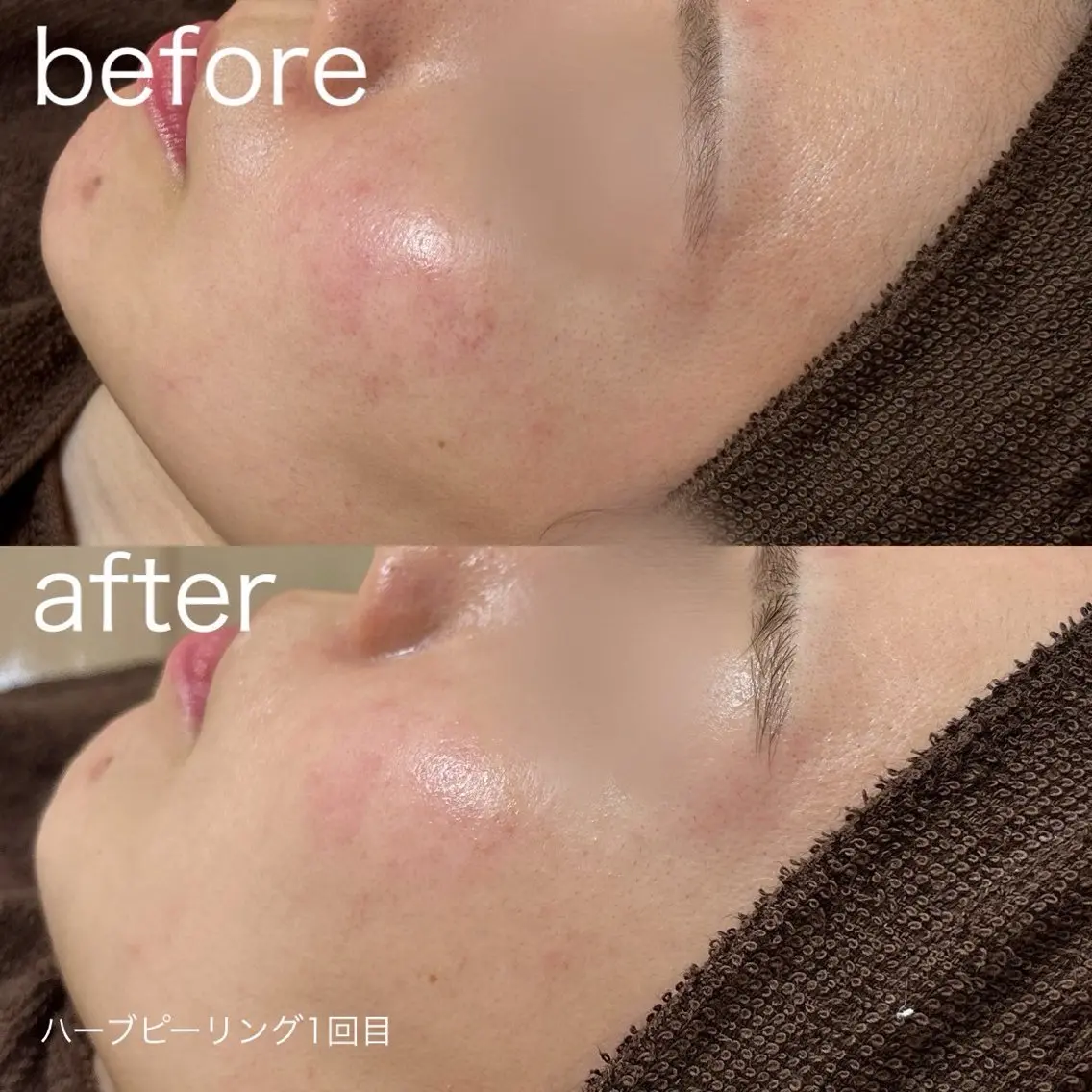 脱毛 lulularico Yuのネイルデザイン