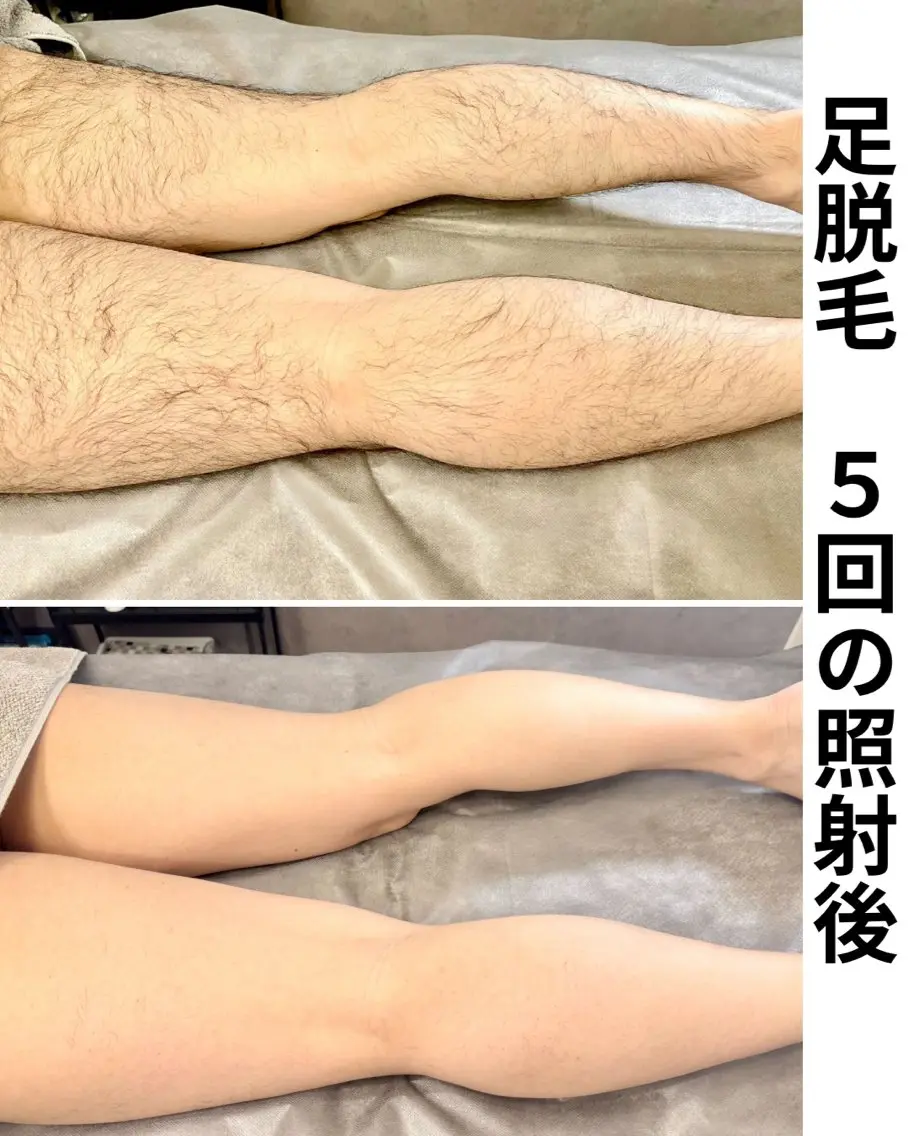 脱毛サロン FIS武蔵小杉店のエステ・リラクイメージ