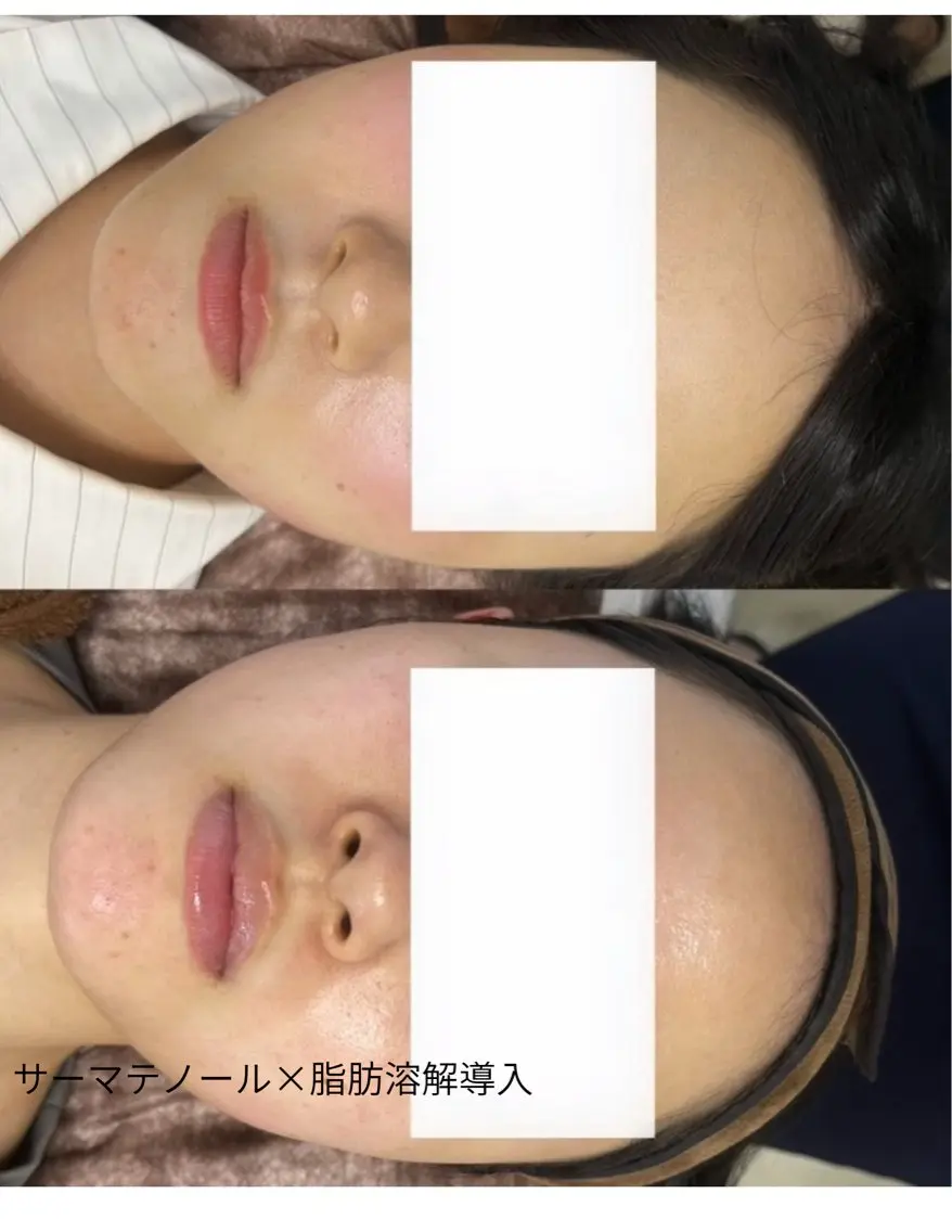 エステ 看護師が施術する美容 ナスサロ/kokoのエステ・リラクイメージ