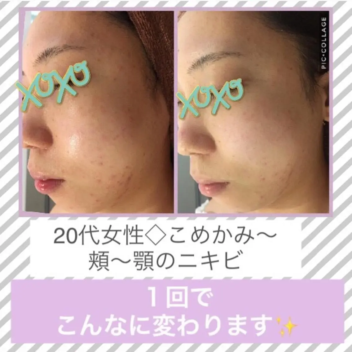 ミディアム カラー パーマ ヘアアレンジ メンズ キッズ ネイル マツエク・マツパ ニキビ・肌質改善専門 ♡人生が変わるサロンのエステ・リラクイメージ