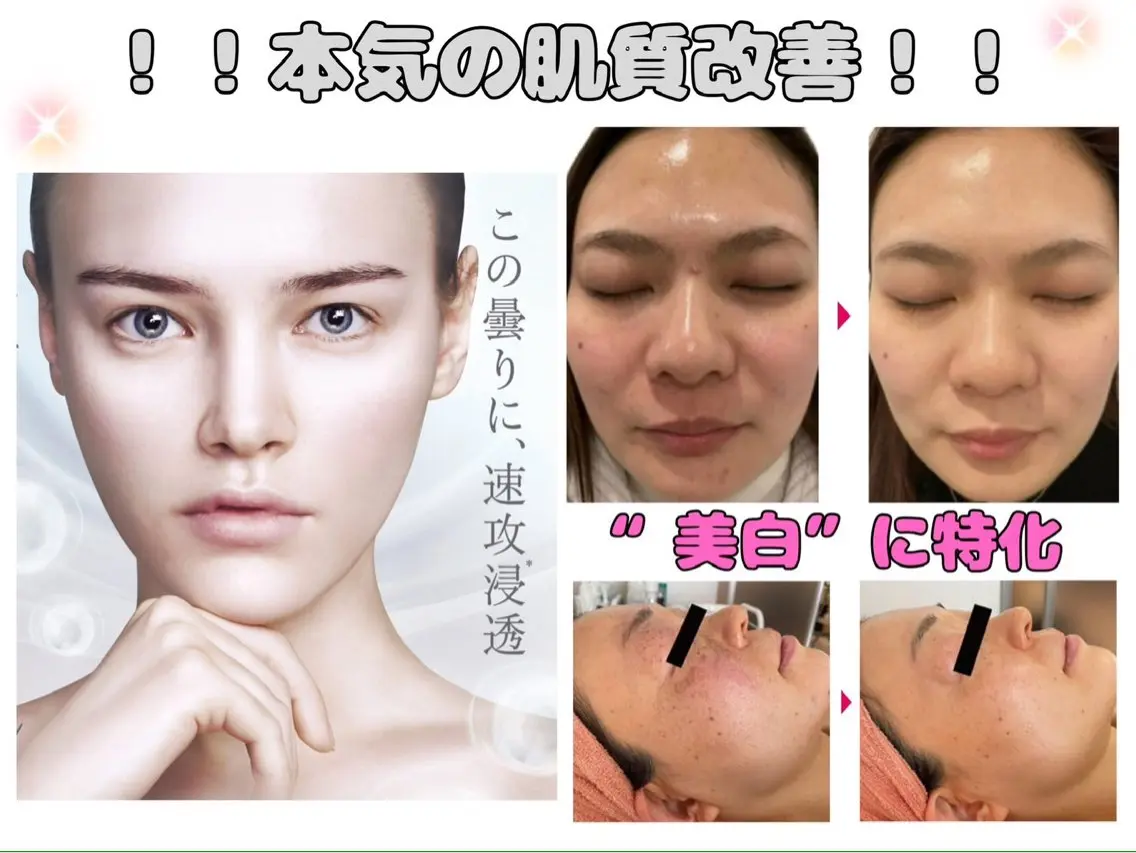 〈毛穴・シミ・くすみケアに〉韓国肌🩷白玉乳酸ピーリングの写真
