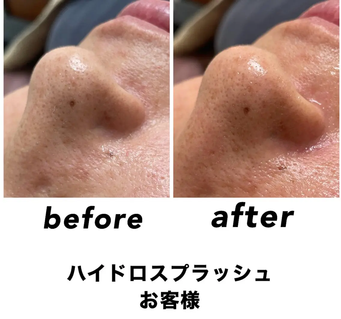 エステ リラク ネイル・エステサロン UILANIのエステ・リラクイメージ