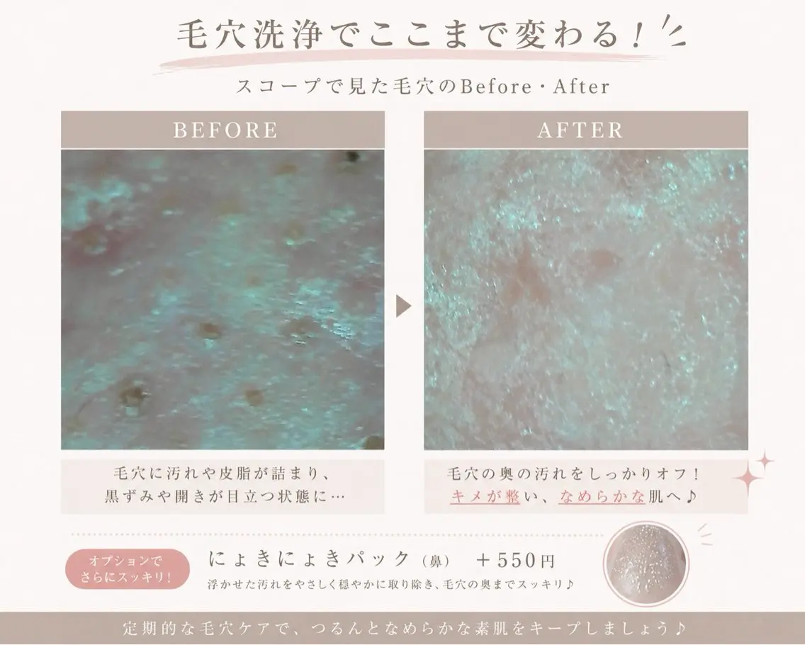 エステ i’m este あまねのエステ・リラクイメージ