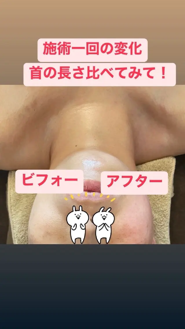 たるみ☆改善フェイシャルの写真
